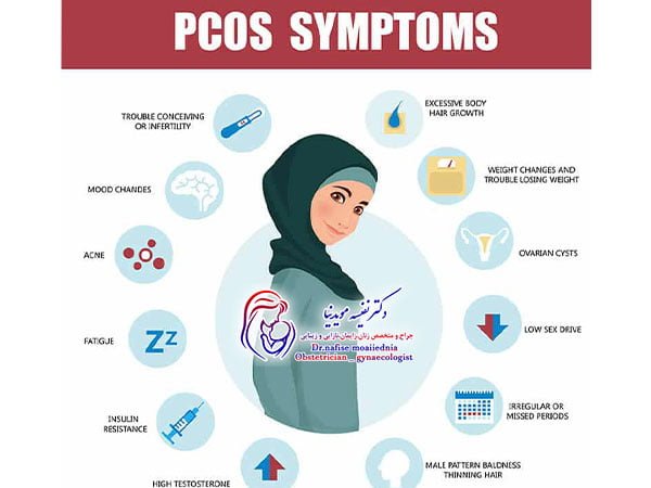 سندرم تخمدان پلیکیستیک (PCOS)