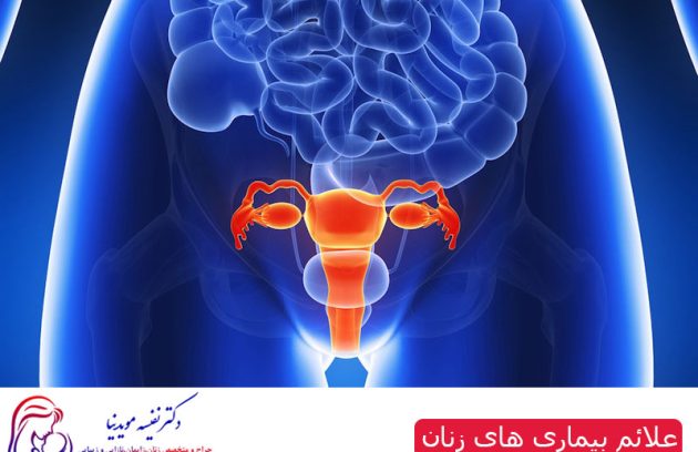 علائم بیماری های زنان