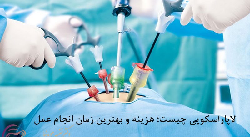 لاپاراسکوپی چیست