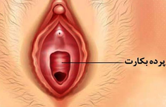 تشخیص-سلامت-پرده-بکارت