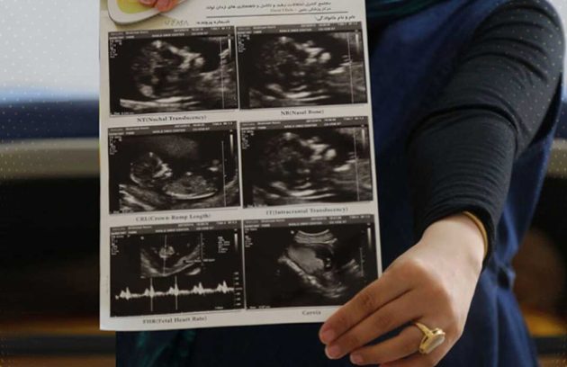 غربالگری-سه-ماهه-اول-بارداری