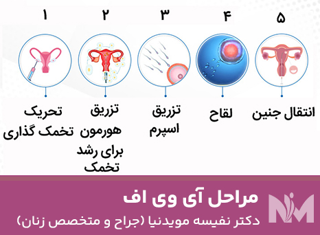 مراحل-آی-وی-اف-