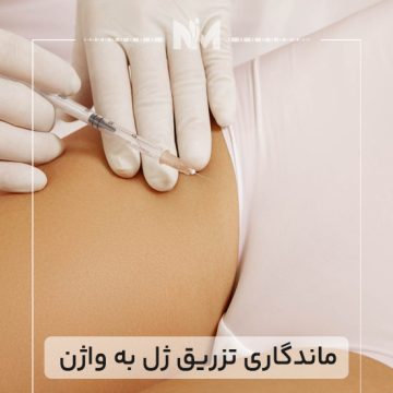 ماندگاری-تزریق-ژل-به-واژن