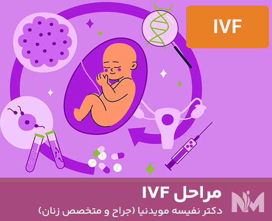 مراحل-IVF
