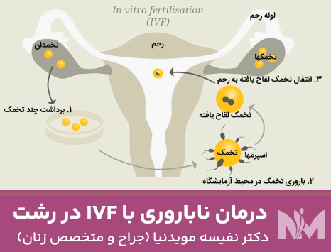 درمان-ناباروری-با-IVF-در-رشت