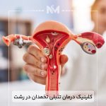کلینیک-درمان-تنبلی-تخمدان-در-رشت